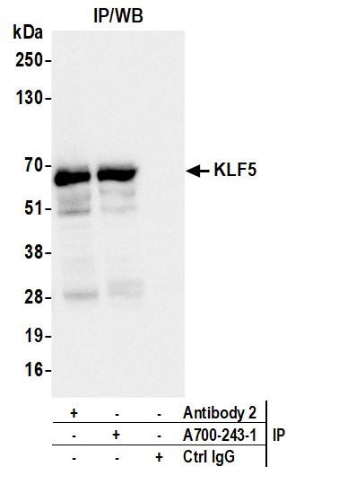 KLF5 Antibody in Immunoprecipitation (IP)