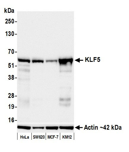 KLF5 Antibody in Western Blot (WB)