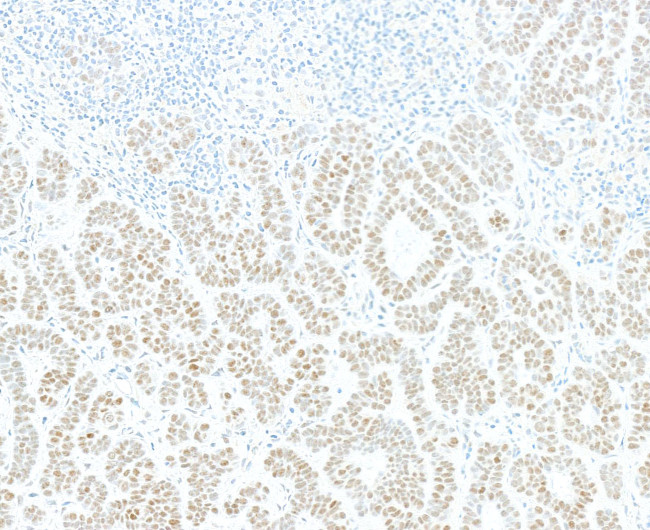 JDP2 Antibody in Immunohistochemistry (Paraffin) (IHC (P))