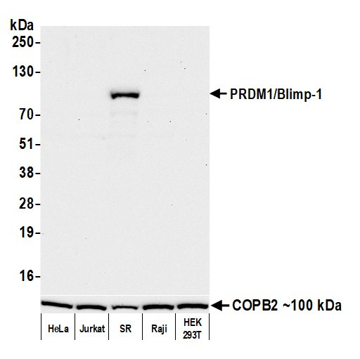 PRDM1/Blimp-1 Antibody in Western Blot (WB)