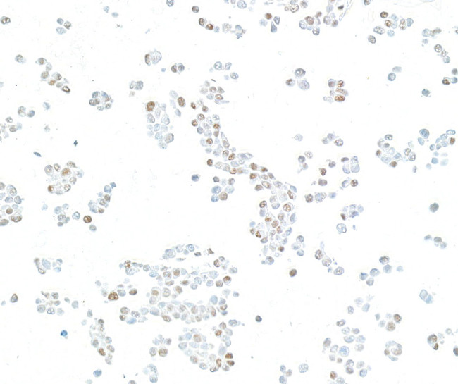 KLF4 Antibody in Immunocytochemistry (ICC/IF)