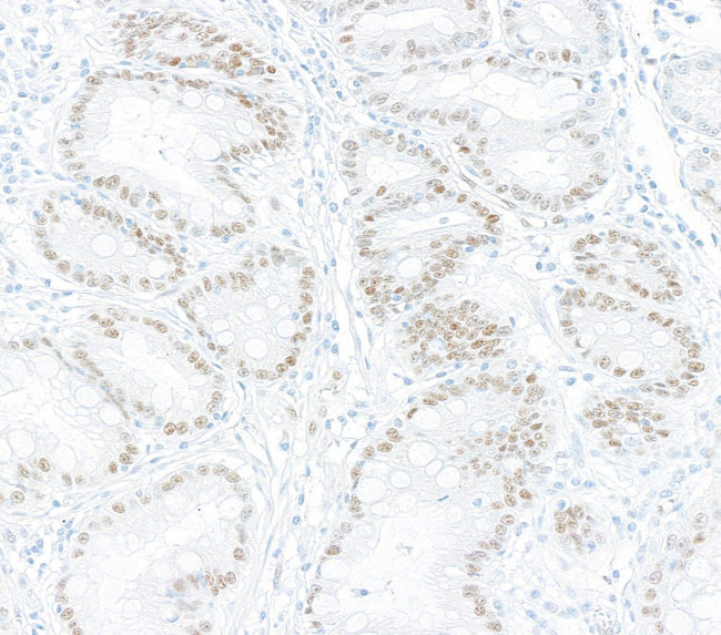 KLF4 Antibody in Immunohistochemistry (Paraffin) (IHC (P))