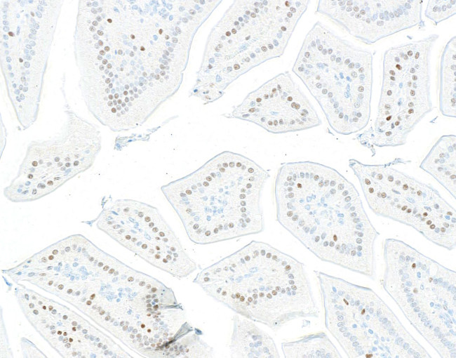 KLF4 Antibody in Immunohistochemistry (Paraffin) (IHC (P))