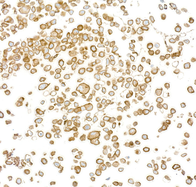 EGFR Antibody in Immunocytochemistry (ICC/IF)