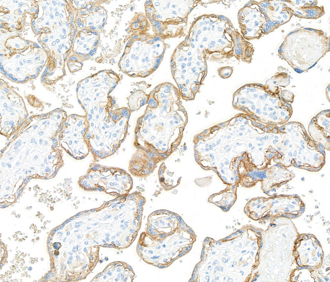 EGFR Antibody in Immunohistochemistry (Paraffin) (IHC (P))