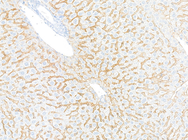 EGFR Antibody in Immunohistochemistry (Paraffin) (IHC (P))