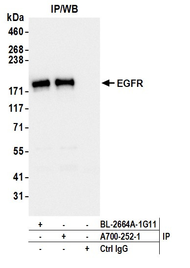 EGFR Antibody in Immunoprecipitation (IP)