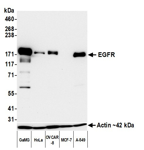 EGFR Antibody in Western Blot (WB)