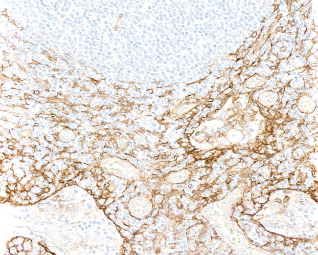 Thrombomodulin Antibody in Immunohistochemistry (Paraffin) (IHC (P))