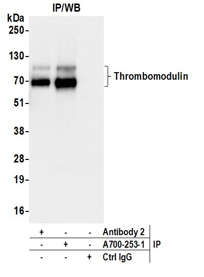 Thrombomodulin Antibody in Immunoprecipitation (IP)