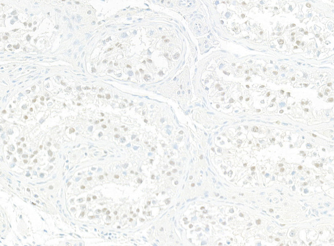 JMJD6 Antibody in Immunohistochemistry (Paraffin) (IHC (P))