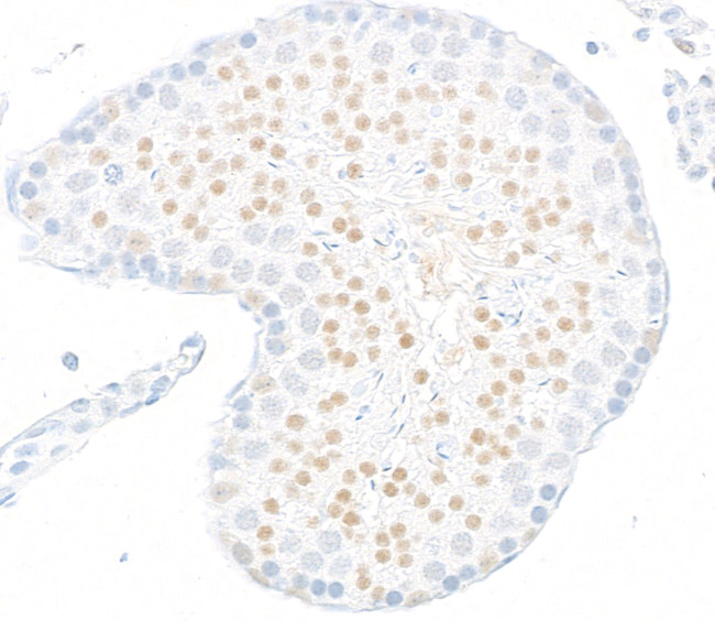 JMJD6 Antibody in Immunohistochemistry (Paraffin) (IHC (P))