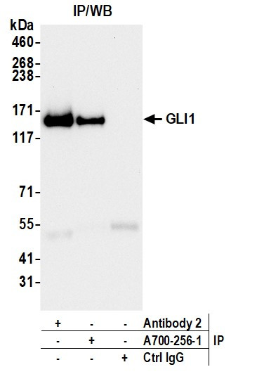 GLI1 Antibody in Immunoprecipitation (IP)