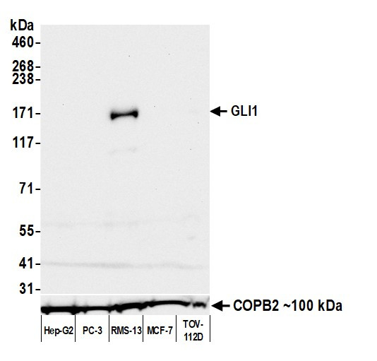 GLI1 Antibody in Western Blot (WB)