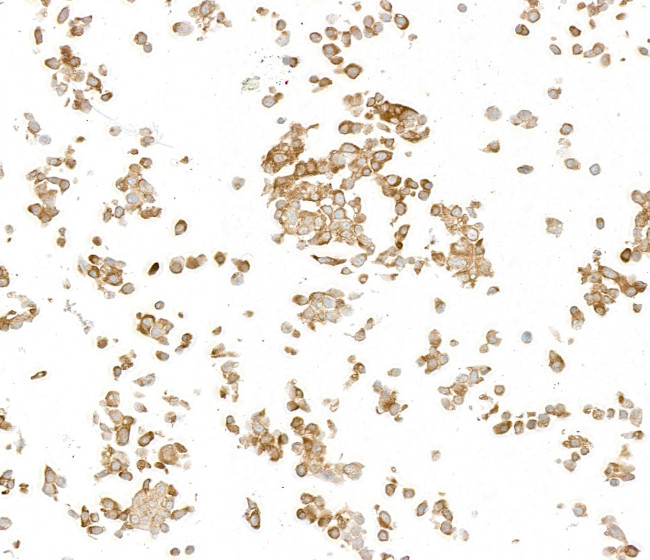 LYRIC/AEG1 Antibody in Immunocytochemistry (ICC/IF)