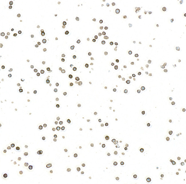 Thrombomodulin Antibody in Immunocytochemistry (ICC/IF)