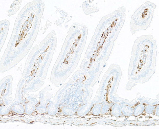 Thrombomodulin Antibody in Immunohistochemistry (Paraffin) (IHC (P))