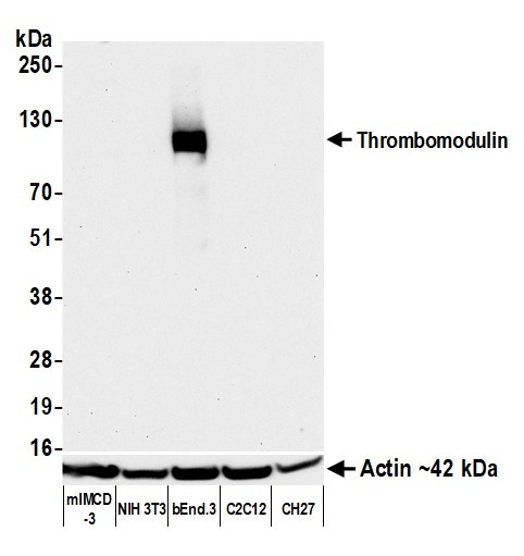 Thrombomodulin Antibody in Western Blot (WB)