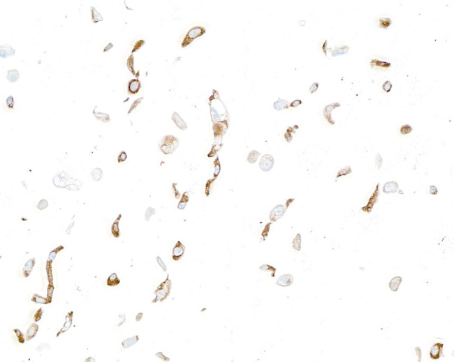 LOX-1 Antibody in Immunocytochemistry (ICC/IF)