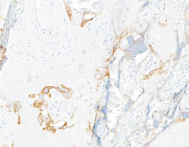 LOX-1 Antibody in Immunohistochemistry (Paraffin) (IHC (P))