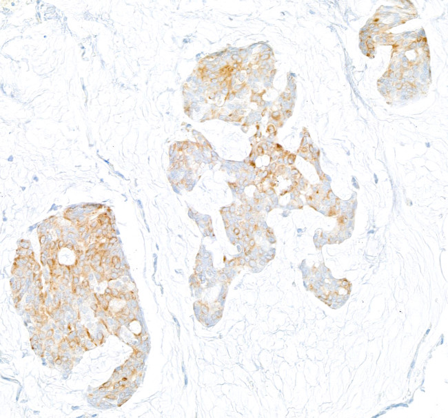 LOX-1 Antibody in Immunohistochemistry (Paraffin) (IHC (P))