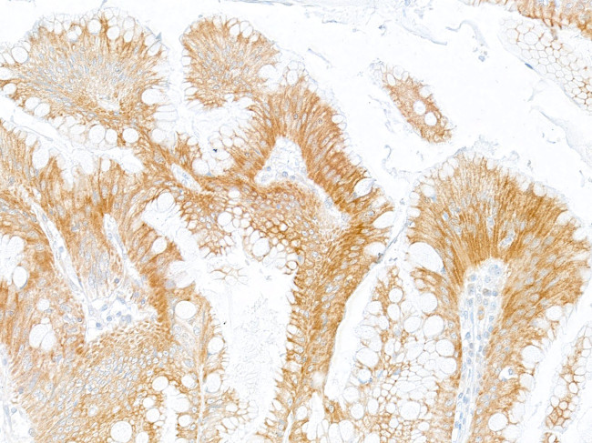 LOX-1 Antibody in Immunohistochemistry (Paraffin) (IHC (P))