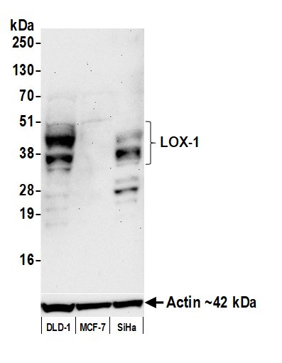 LOX-1 Antibody in Western Blot (WB)