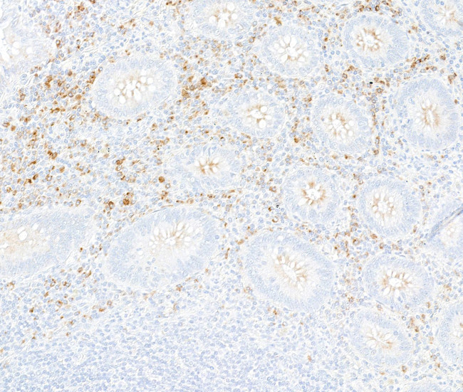 Interferon alpha/beta receptor 1 Antibody in Immunohistochemistry (Paraffin) (IHC (P))