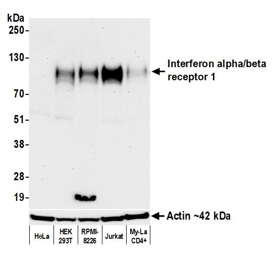 Interferon alpha/beta receptor 1 Antibody in Western Blot (WB)