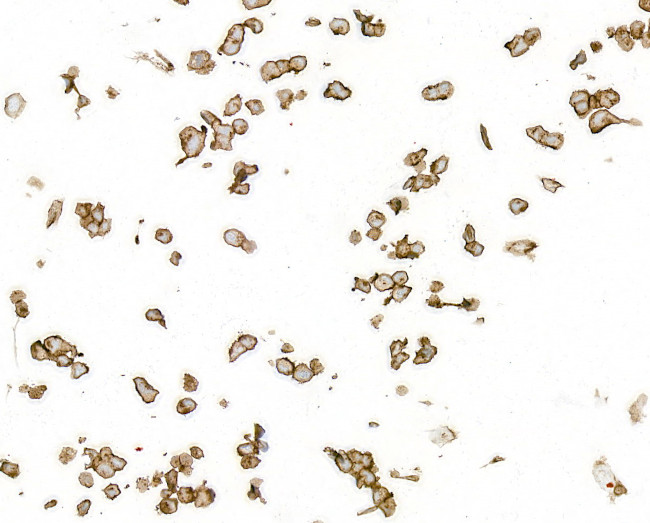 CD70 Antibody in Immunocytochemistry (ICC/IF)