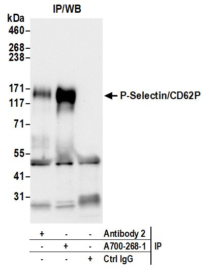P-Selectin/CD62P Antibody in Immunoprecipitation (IP)