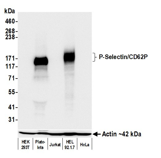 P-Selectin/CD62P Antibody in Western Blot (WB)