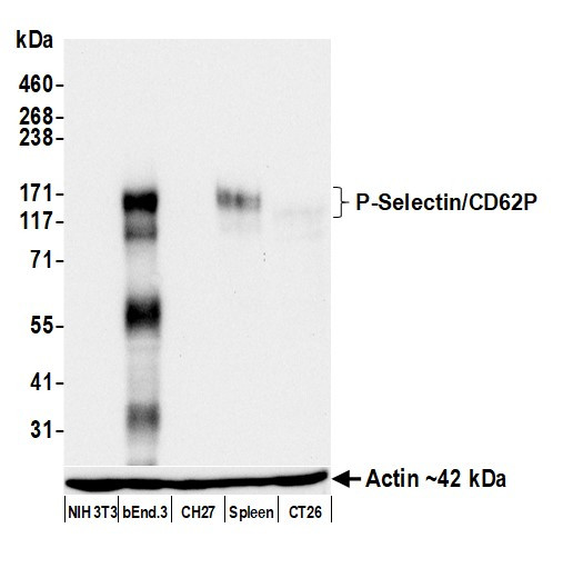 P-Selectin/CD62P Antibody in Western Blot (WB)