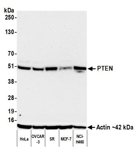 PTEN Antibody in Western Blot (WB)