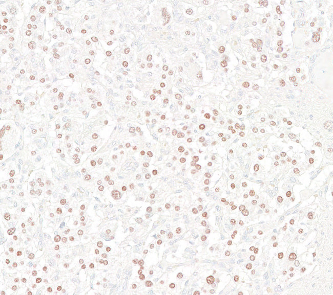 INSM1 Antibody in Immunohistochemistry (Paraffin) (IHC (P))