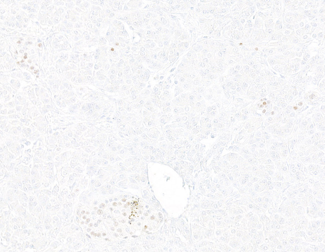 INSM1 Antibody in Immunohistochemistry (Paraffin) (IHC (P))