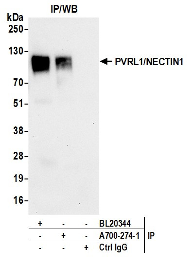 PVRL1/NECTIN1 Antibody in Immunoprecipitation (IP)