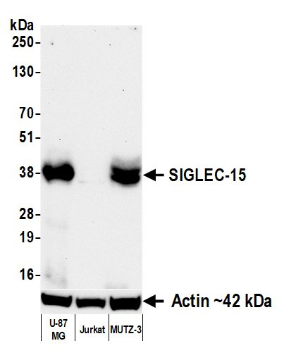 SIGLEC-15 Antibody in Western Blot (WB)