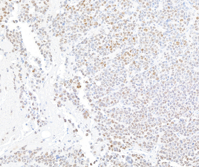 ARID1A/BAF250 Antibody in Immunohistochemistry (Paraffin) (IHC (P))