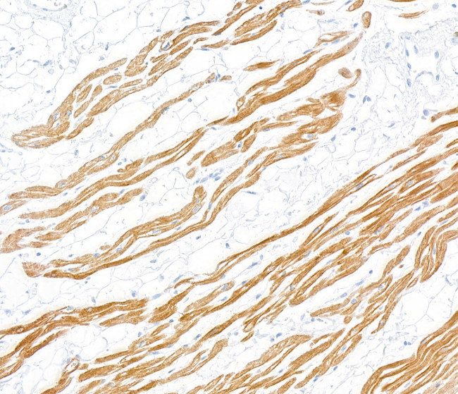 Troponin I Antibody in Immunohistochemistry (Paraffin) (IHC (P))