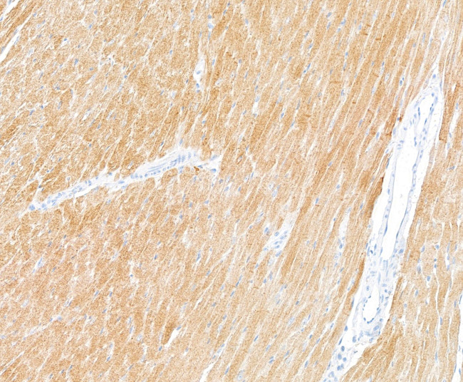 Troponin I Antibody in Immunohistochemistry (Paraffin) (IHC (P))