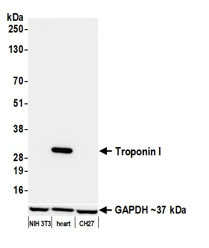 Troponin I Antibody in Western Blot (WB)