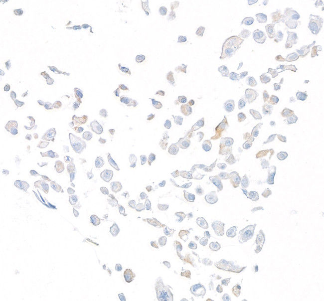 DPP4/CD26 Antibody in Immunocytochemistry (ICC/IF)