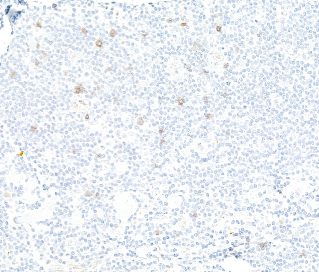 NKG2A Antibody in Immunohistochemistry (Paraffin) (IHC (P))