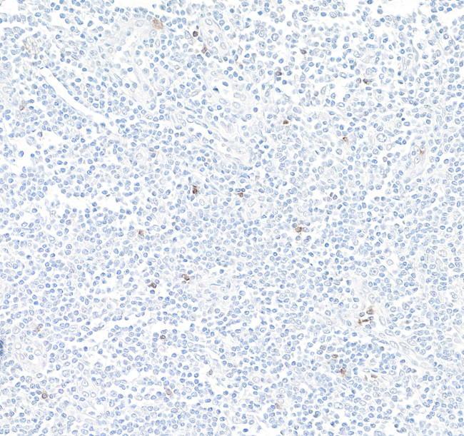 NKG2A Antibody in Immunohistochemistry (Paraffin) (IHC (P))