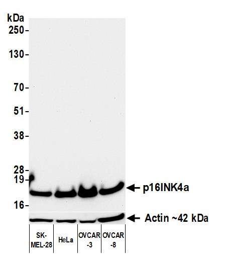 p16INK4a Antibody in Western Blot (WB)