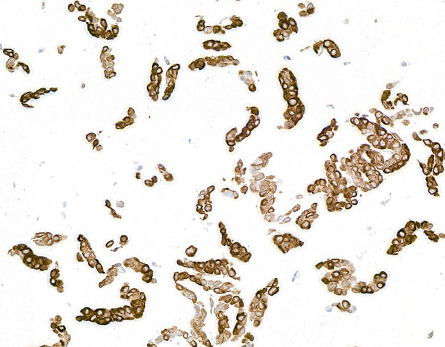 Cytokeratin 14 Antibody in Immunocytochemistry (ICC/IF)