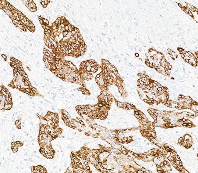 Cytokeratin 14 Antibody in Immunohistochemistry (Paraffin) (IHC (P))