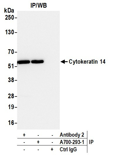 Cytokeratin 14 Antibody in Immunoprecipitation (IP)