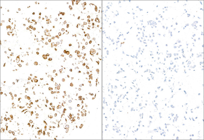 E-Selectin/CD62E Antibody in Immunocytochemistry (ICC/IF)